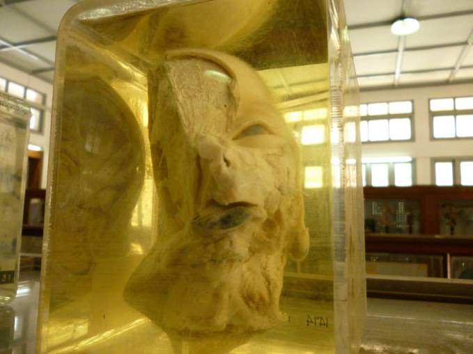 Siriraj Medical Museum